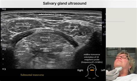 radiographic testing visualize soft tissues|Musculoskeletal Ultrasound for Bone & Soft.